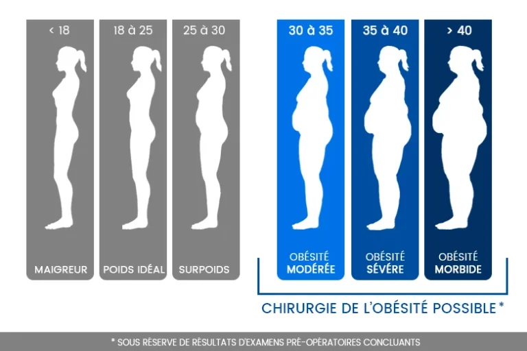 Bypass Gastrique au Maroc – Une Solution Efficace Contre l’Obésité
