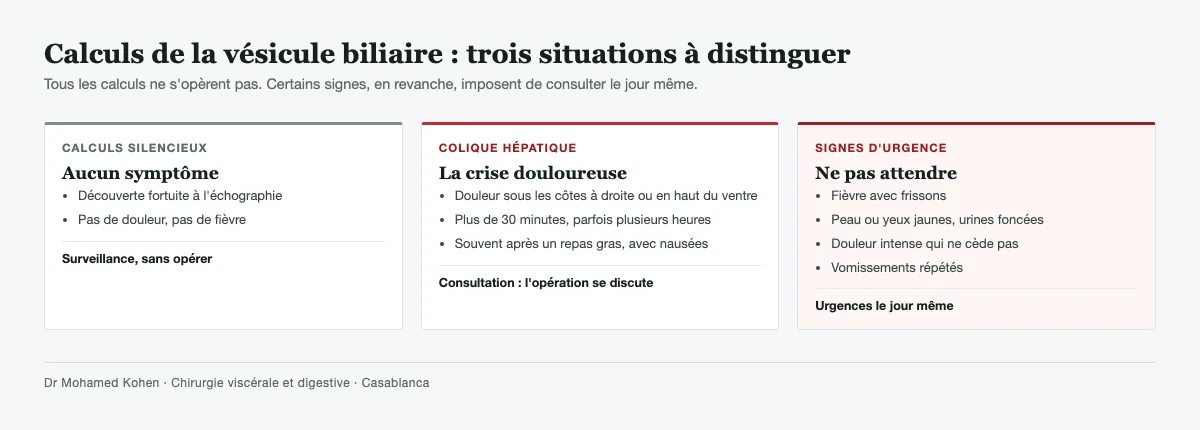 Trois situations liées aux calculs de la vésicule biliaire : calculs silencieux sans symptôme, crise de colique hépatique, et signes d'urgence comme la fièvre avec frissons ou la jaunisse