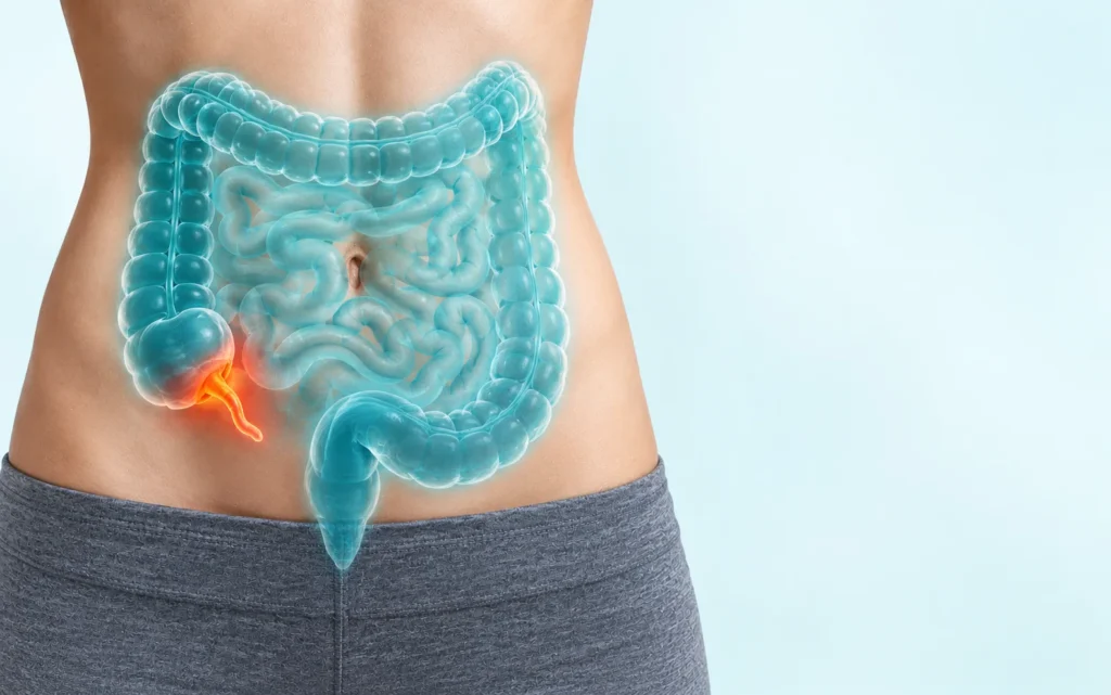 Abdomen avec une illustration 3D du gros intestin montrant un appendice enflammé en bas à droite du ventre