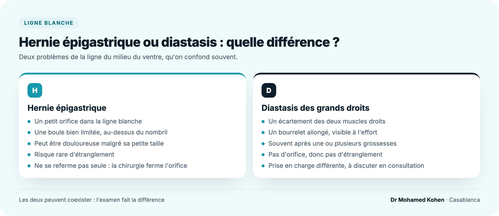 Comparaison entre hernie épigastrique et diastasis des grands droits : petite boule ferme par un orifice d'un côté, bourrelet allongé sans orifice de l'autre